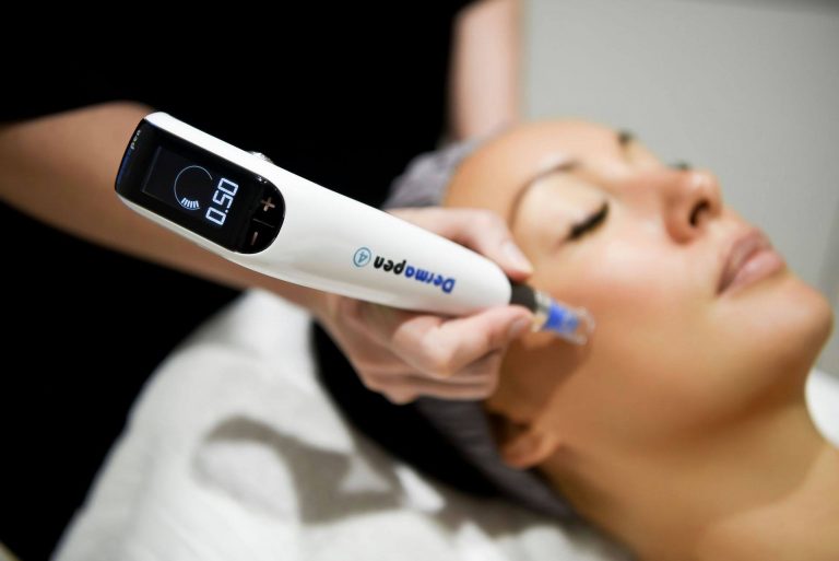 From Dull to Radiant: The Power of Skin Needling