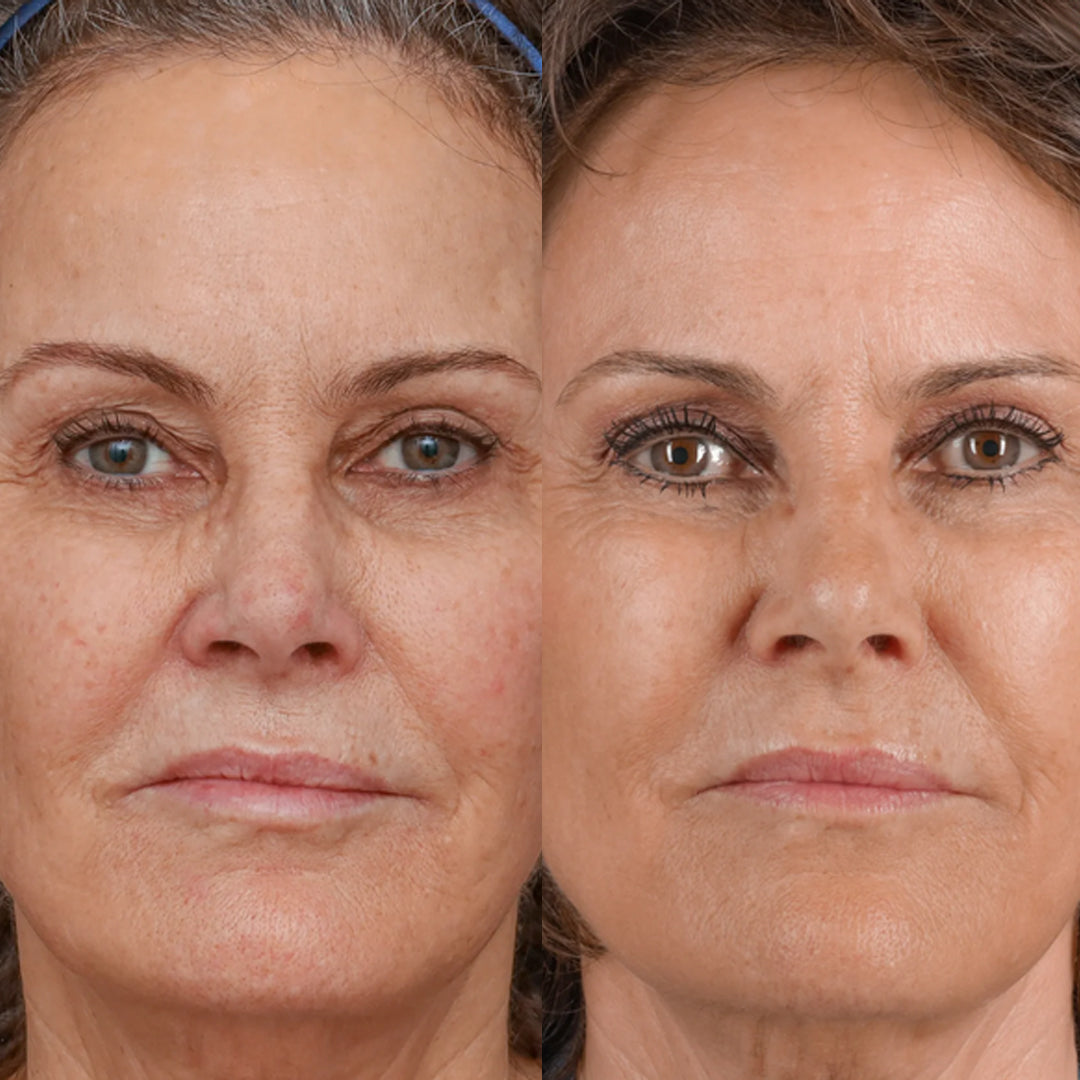 TIMELESS ANTI-AGEING PEEL