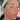 ADD DERMAPEN4 - NUMBING