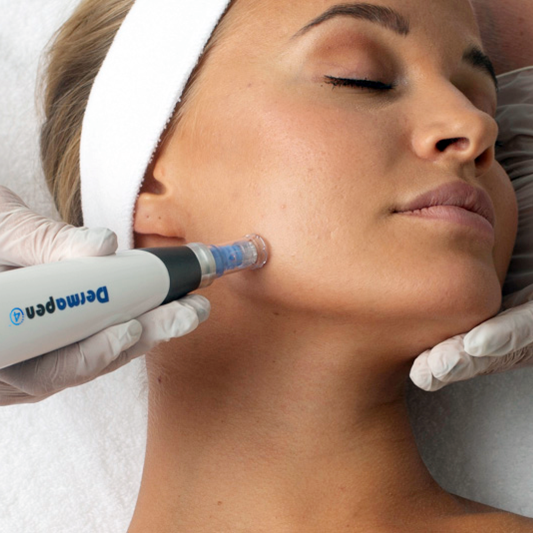 DERMAPEN4 - BODY SKIN NEEDLING A5 AREA